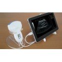 Tablet Ultrasound Scanner (NEW)