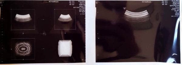 GE RAB6-RS - Imagen 3