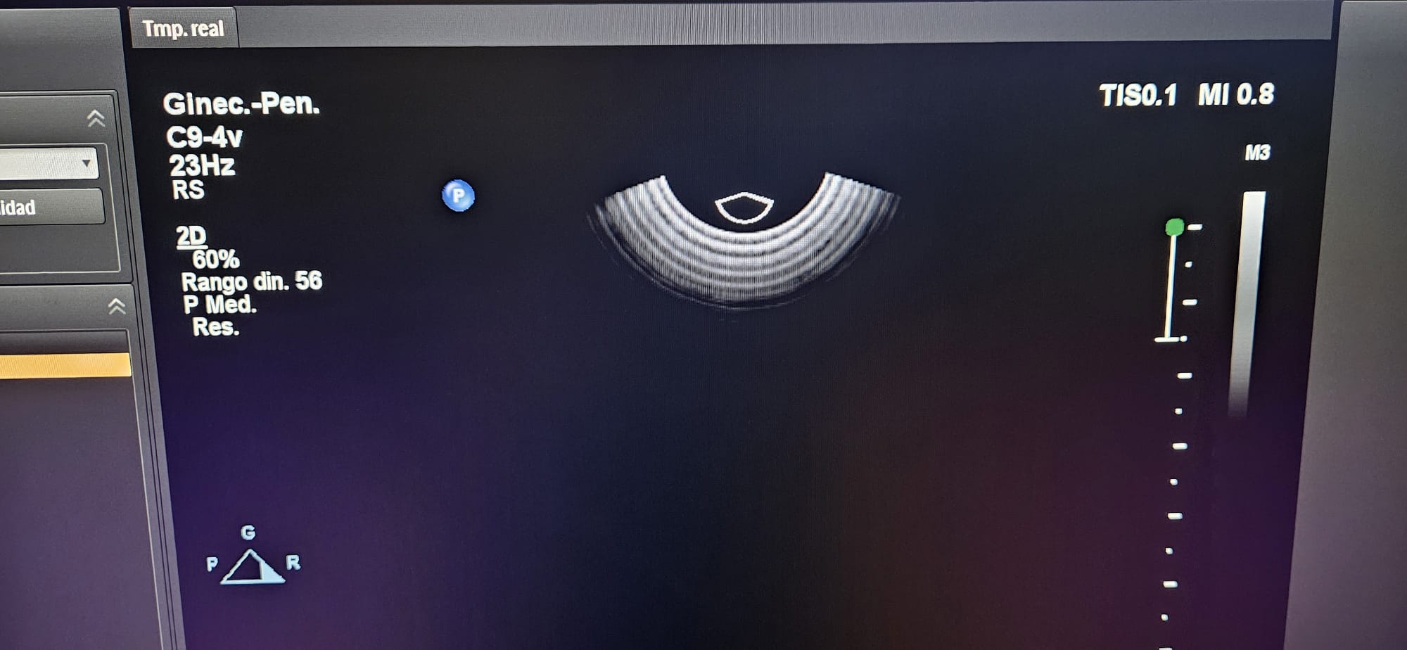 Philips C9-4V Compact - Imagen 2