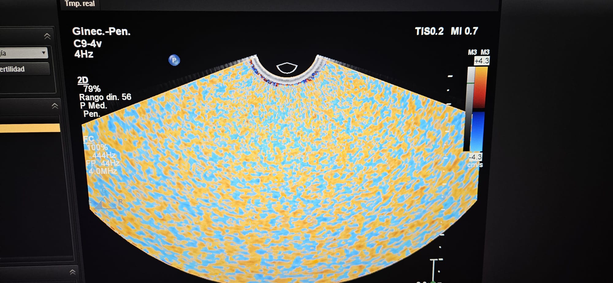 Philips C9-4V Compact - Imagen 3