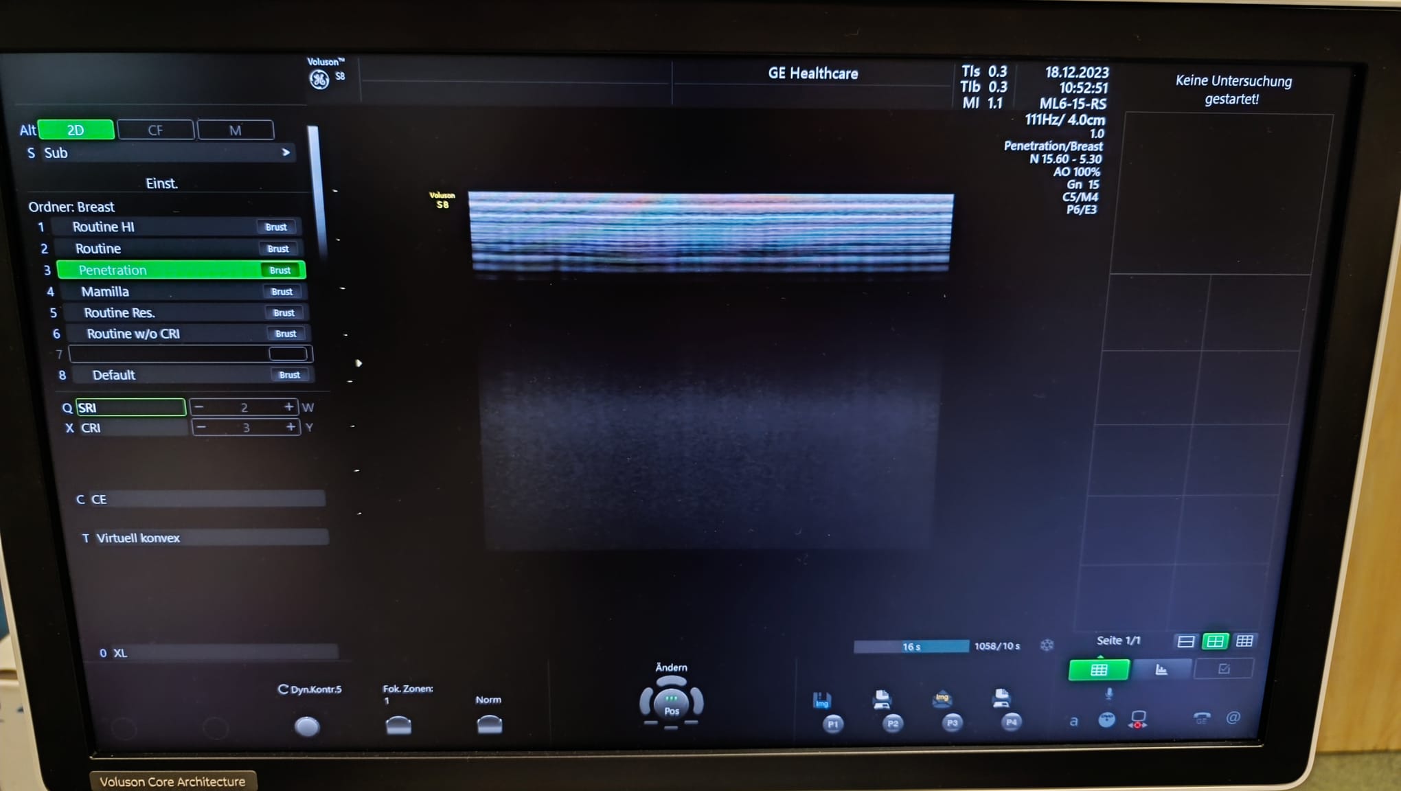 GE ML6-15-RS - Imagen 5