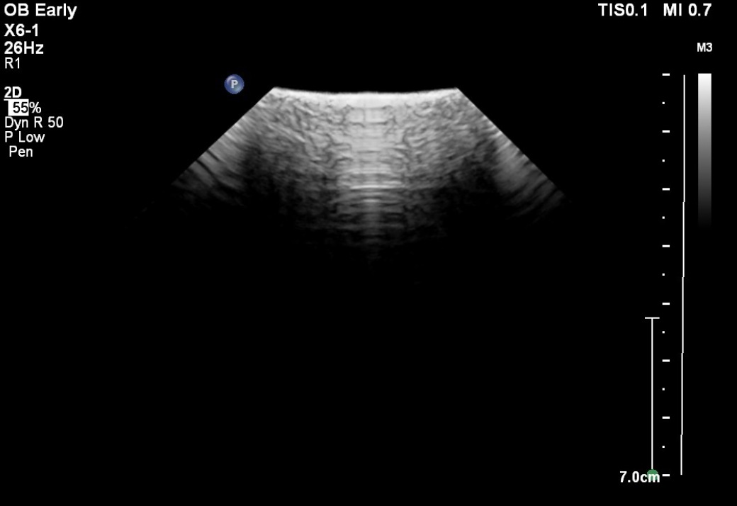 Philips X6-1 Compact - Imagen 7