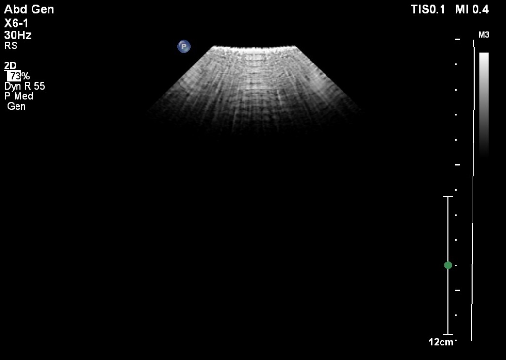 Philips X6-1 Compact - Imagen 6