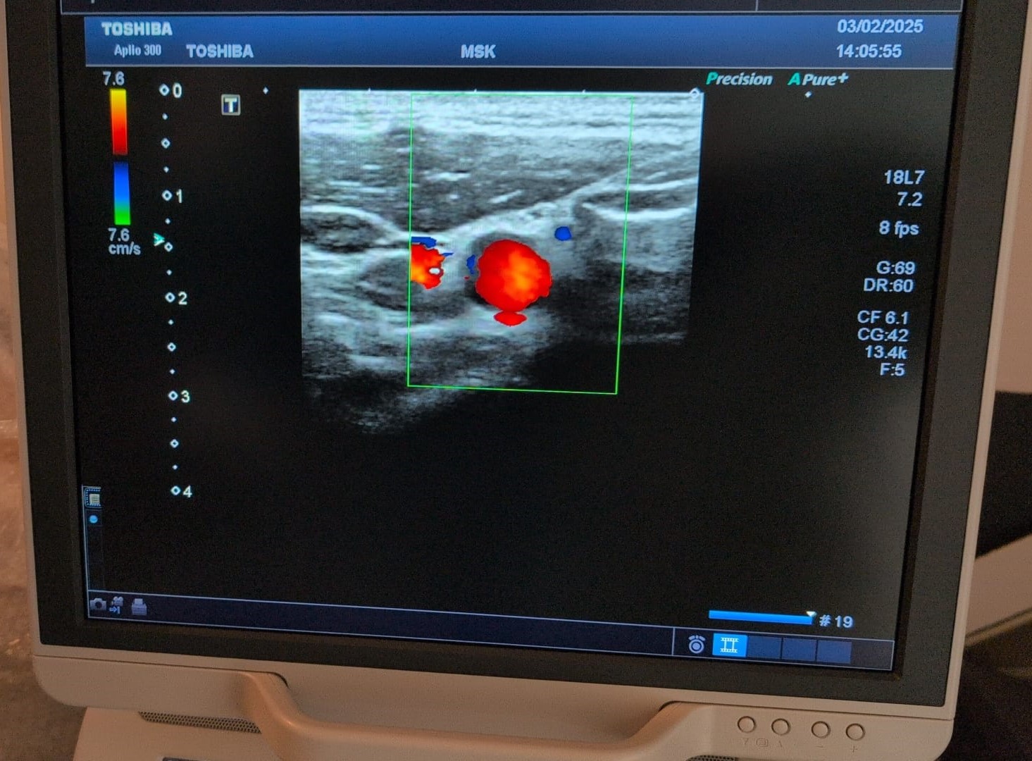 Toshiba PLT-1204BT - Imagen 4