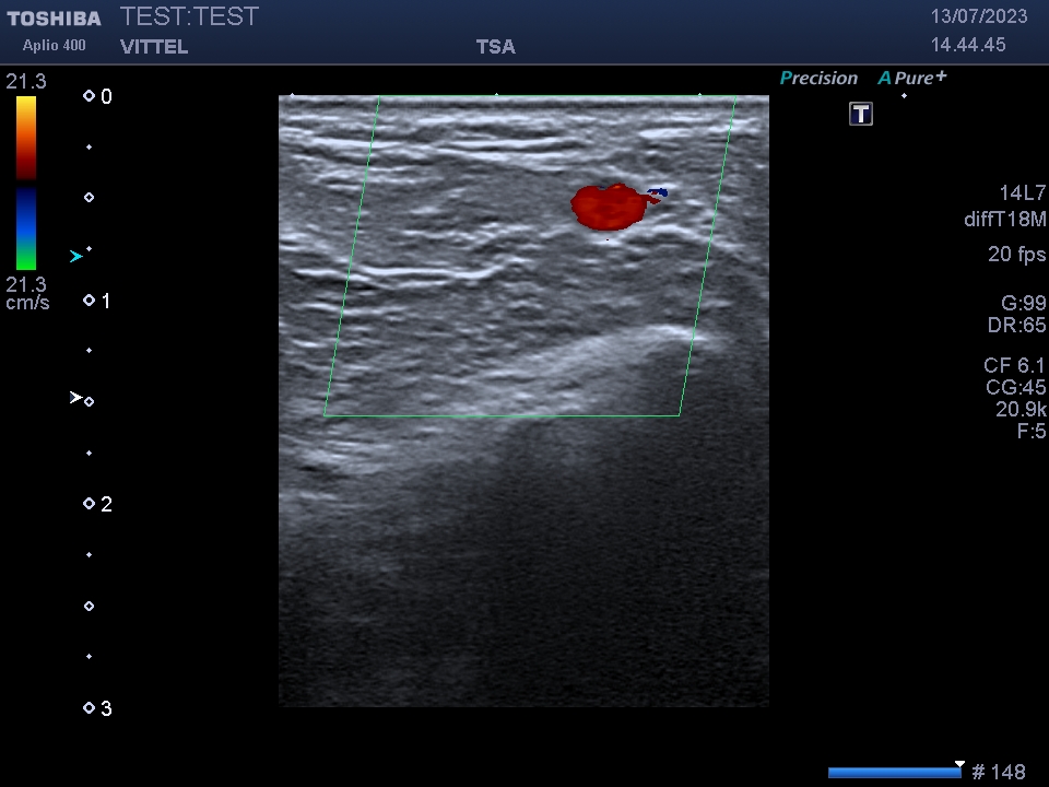 Toshiba PLT-1202S - Imagen 3
