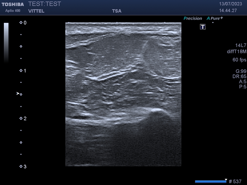 Toshiba PLT-1202S - Imagen 4