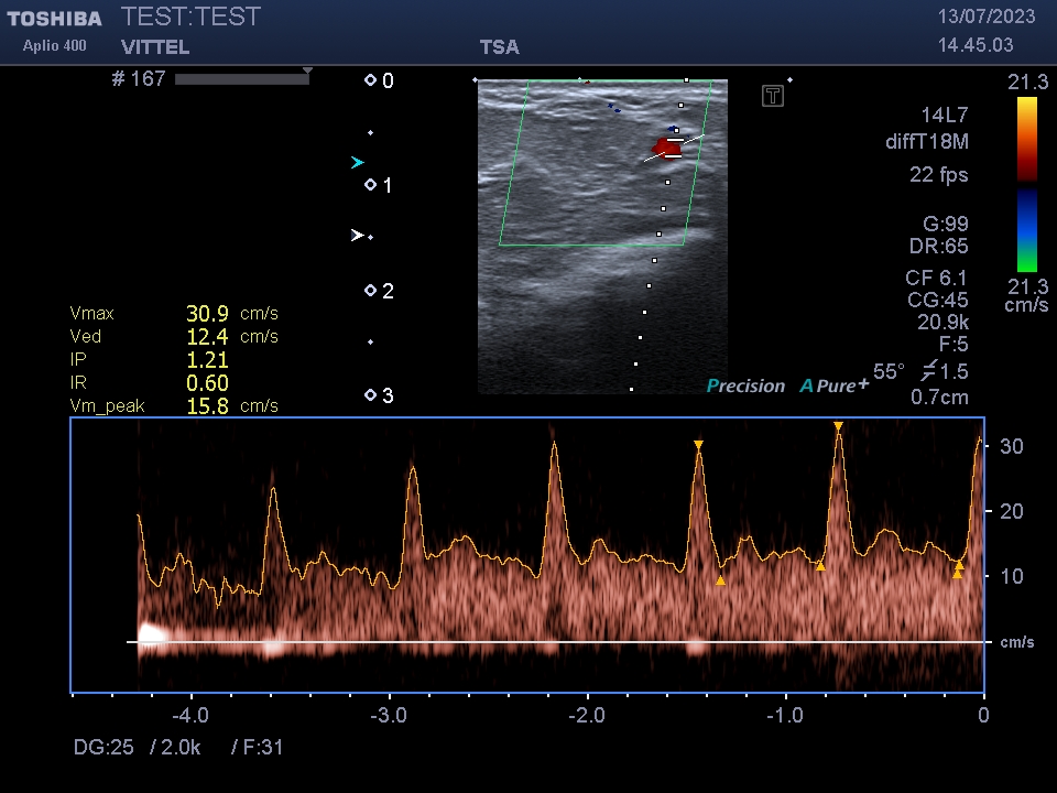 Toshiba PLT-1202S - Imagen 6