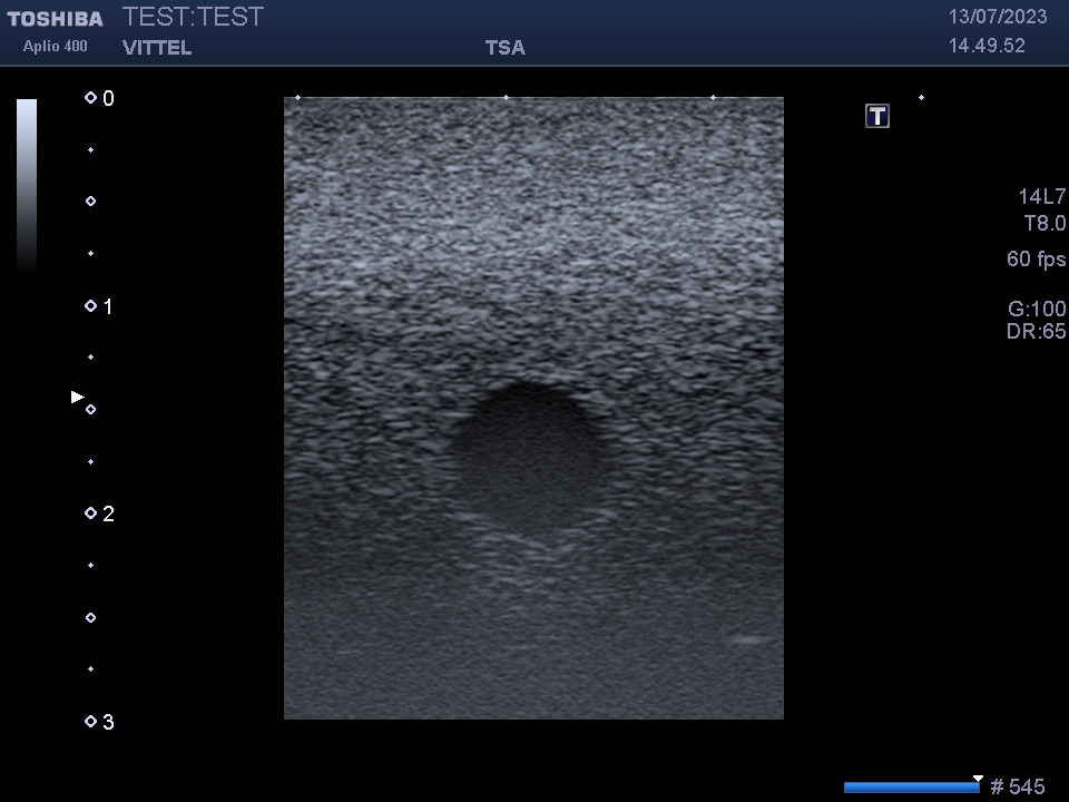 Toshiba PLT-1202S - Imagen 8