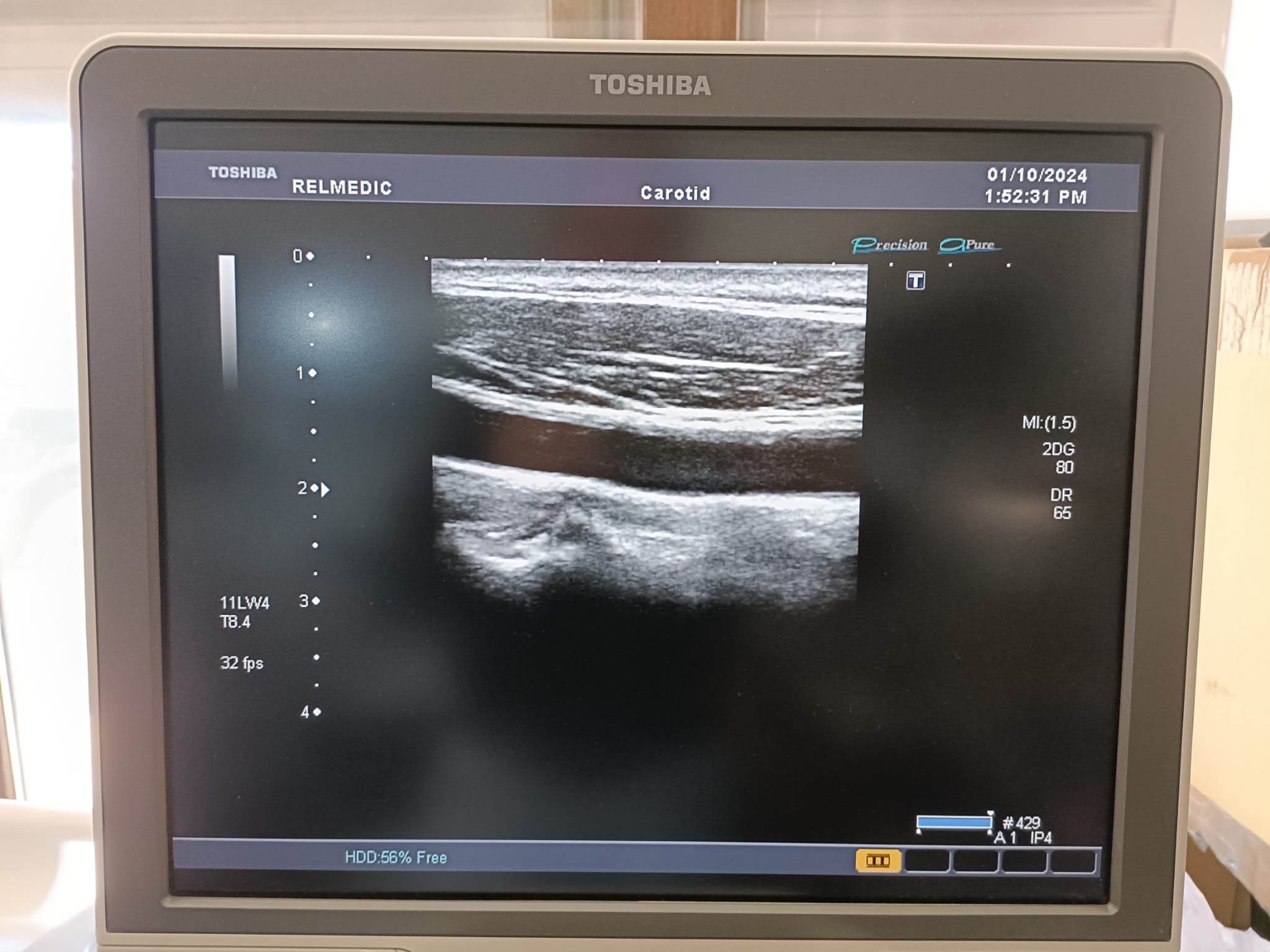 Toshiba PLT-704SBT - Imagen 5