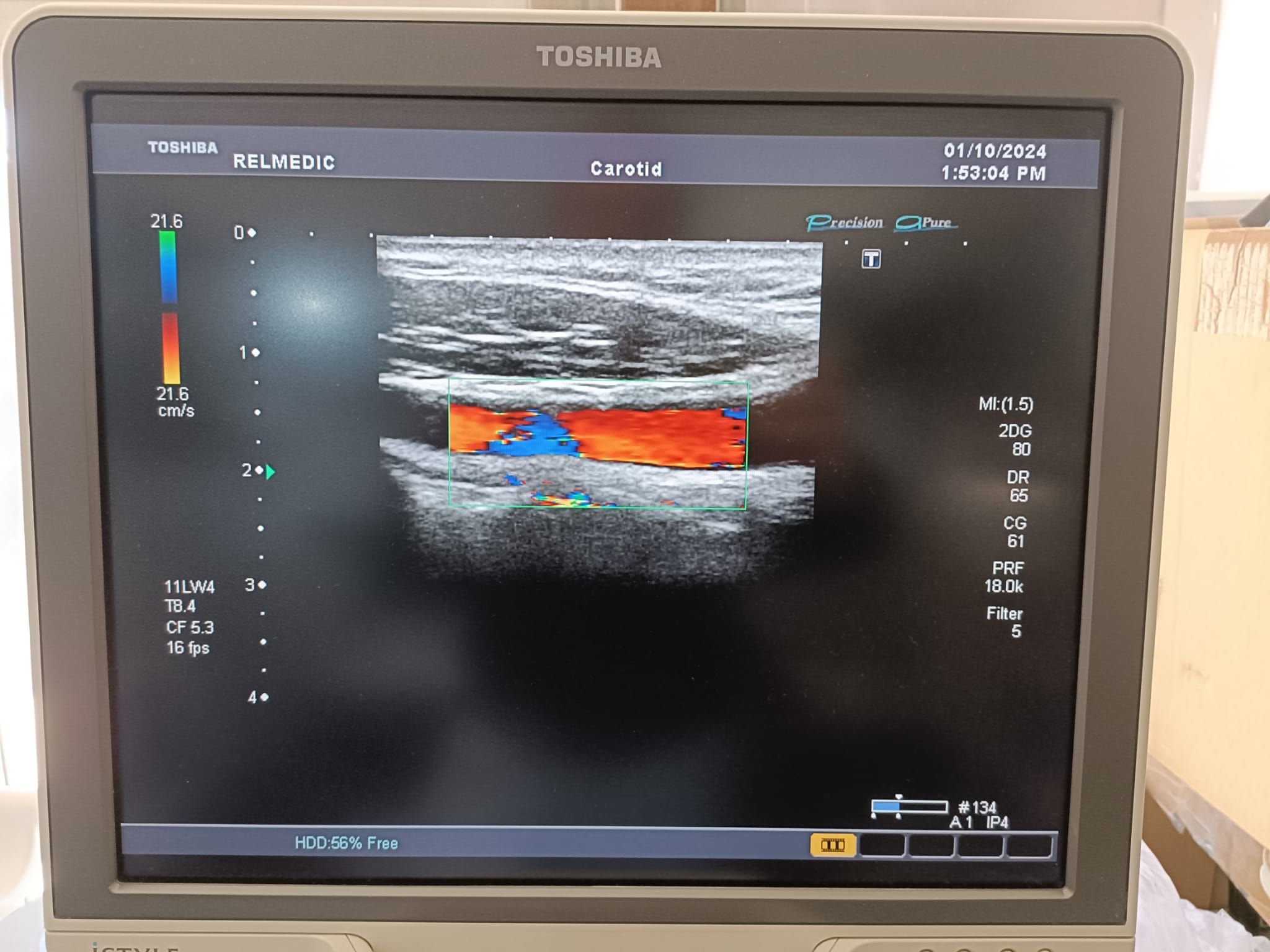 Toshiba PLT-704SBT - Imagen 4