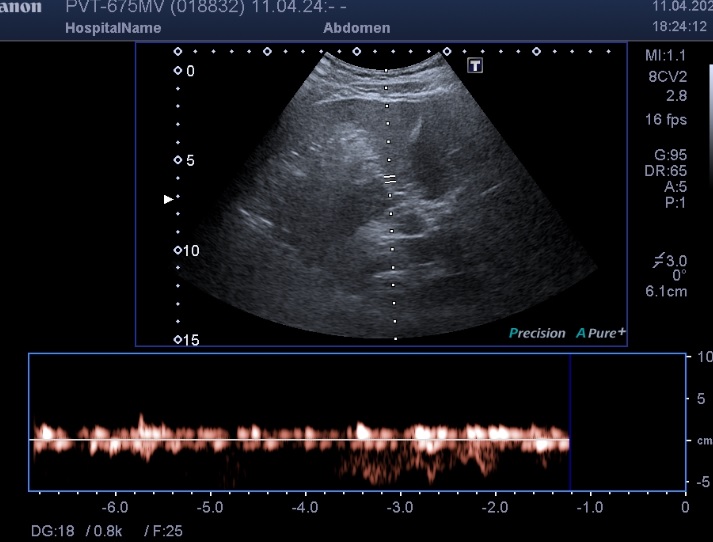 Toshiba PVT-675MV - Imagen 6