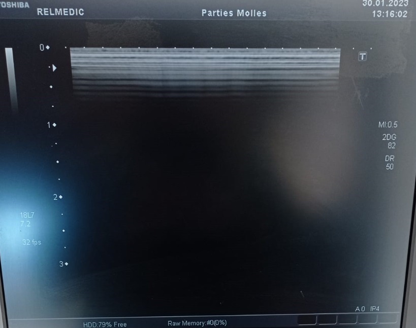 Toshiba PLT-1204BT - Imagen 2