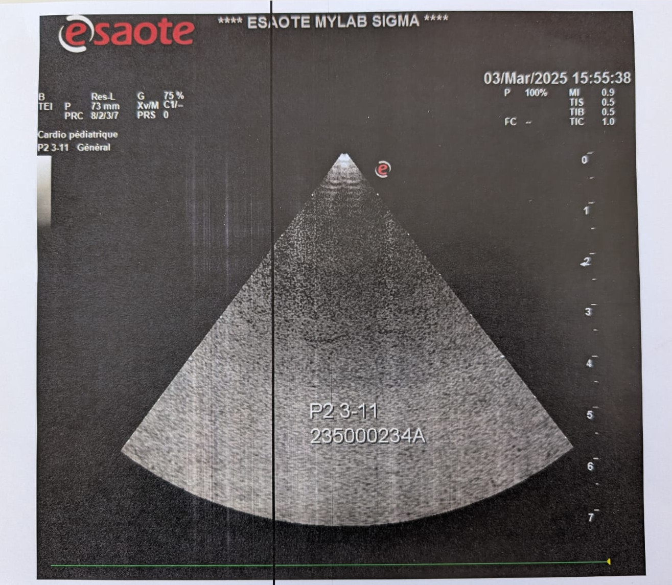 Esaote P2 3-11 - Imagen 3