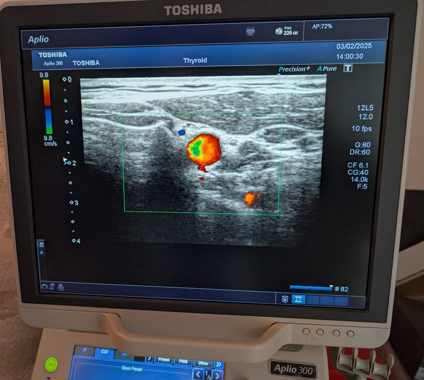 Toshiba PLT-805AT - Imagen 3