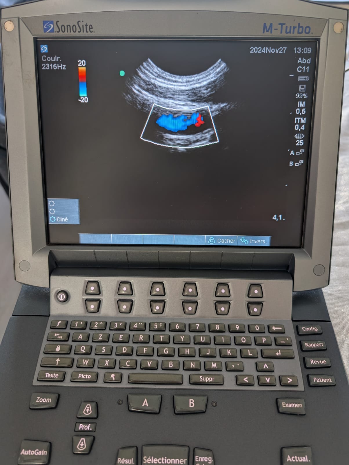 Sonosite C11X - Imagen 4