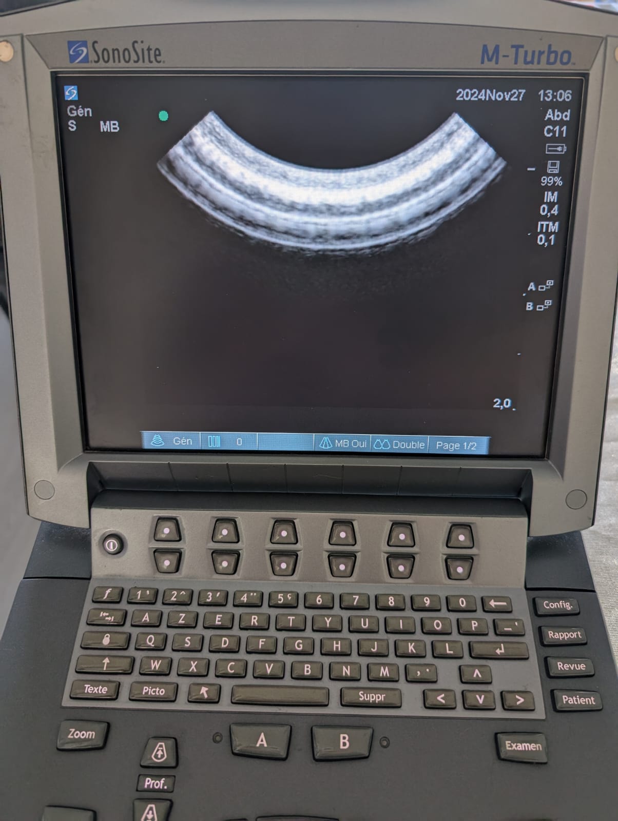 Sonosite C11X - Imagen 5