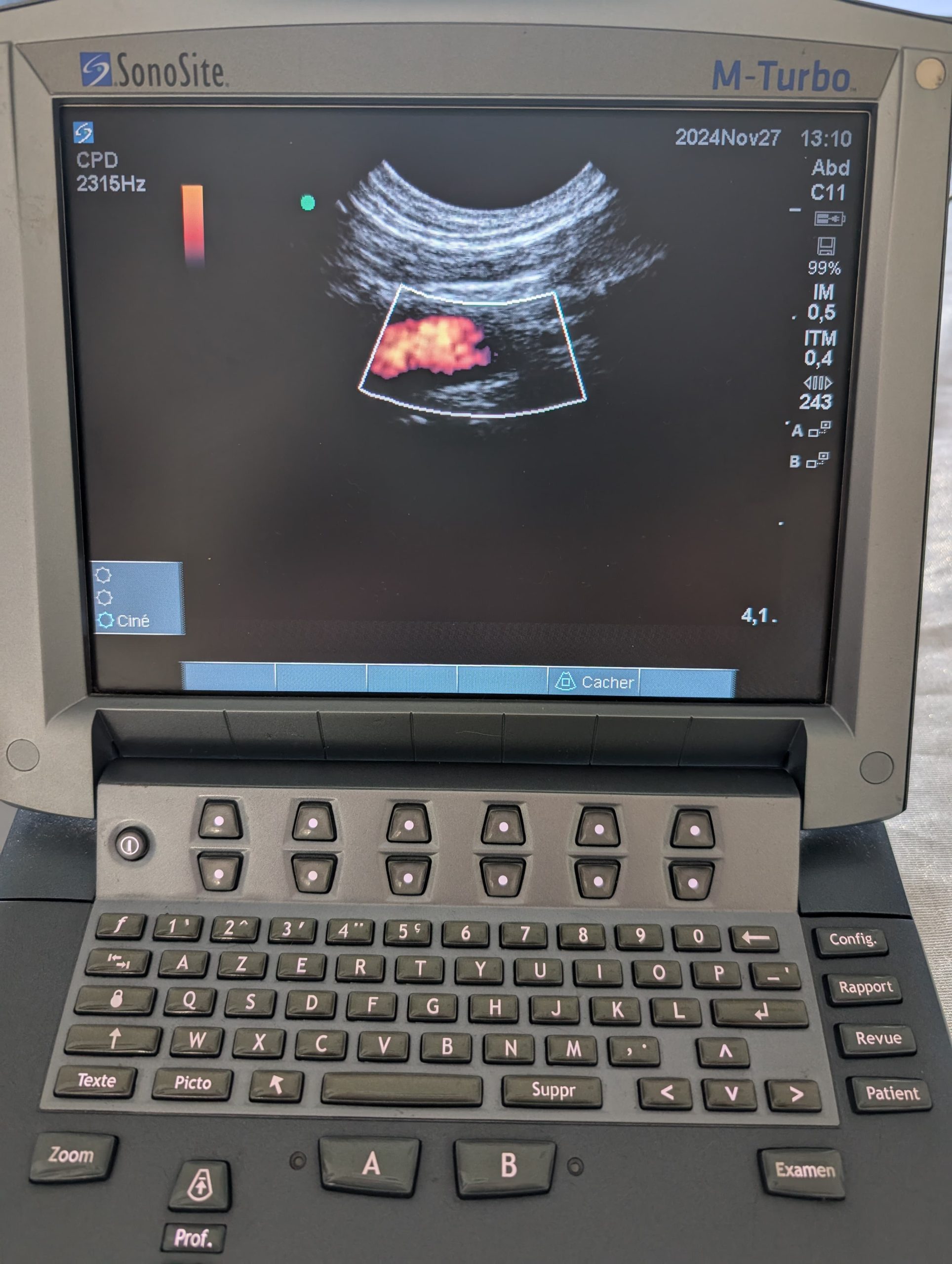 Sonosite C11X - Imagen 6