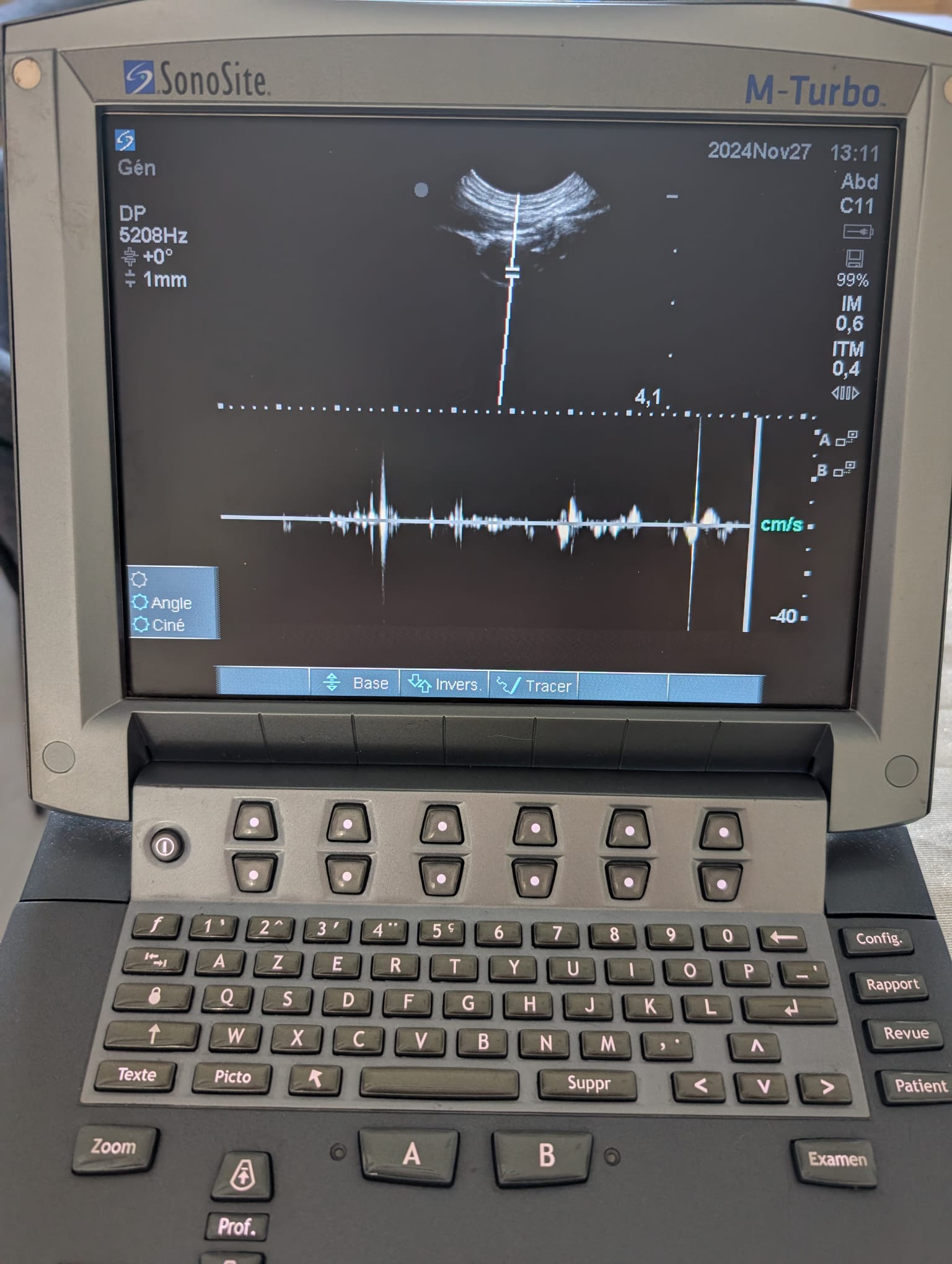 Sonosite C11X - Imagen 7