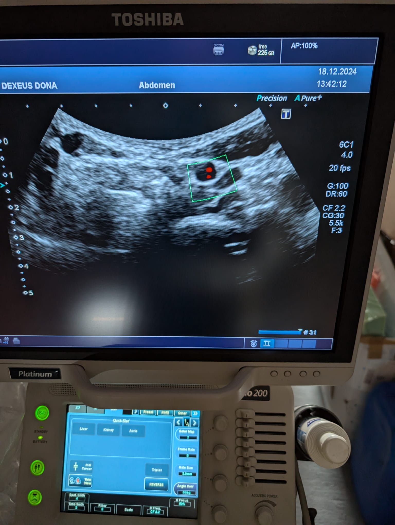 Toshiba PVU-375BT - Imagen 4