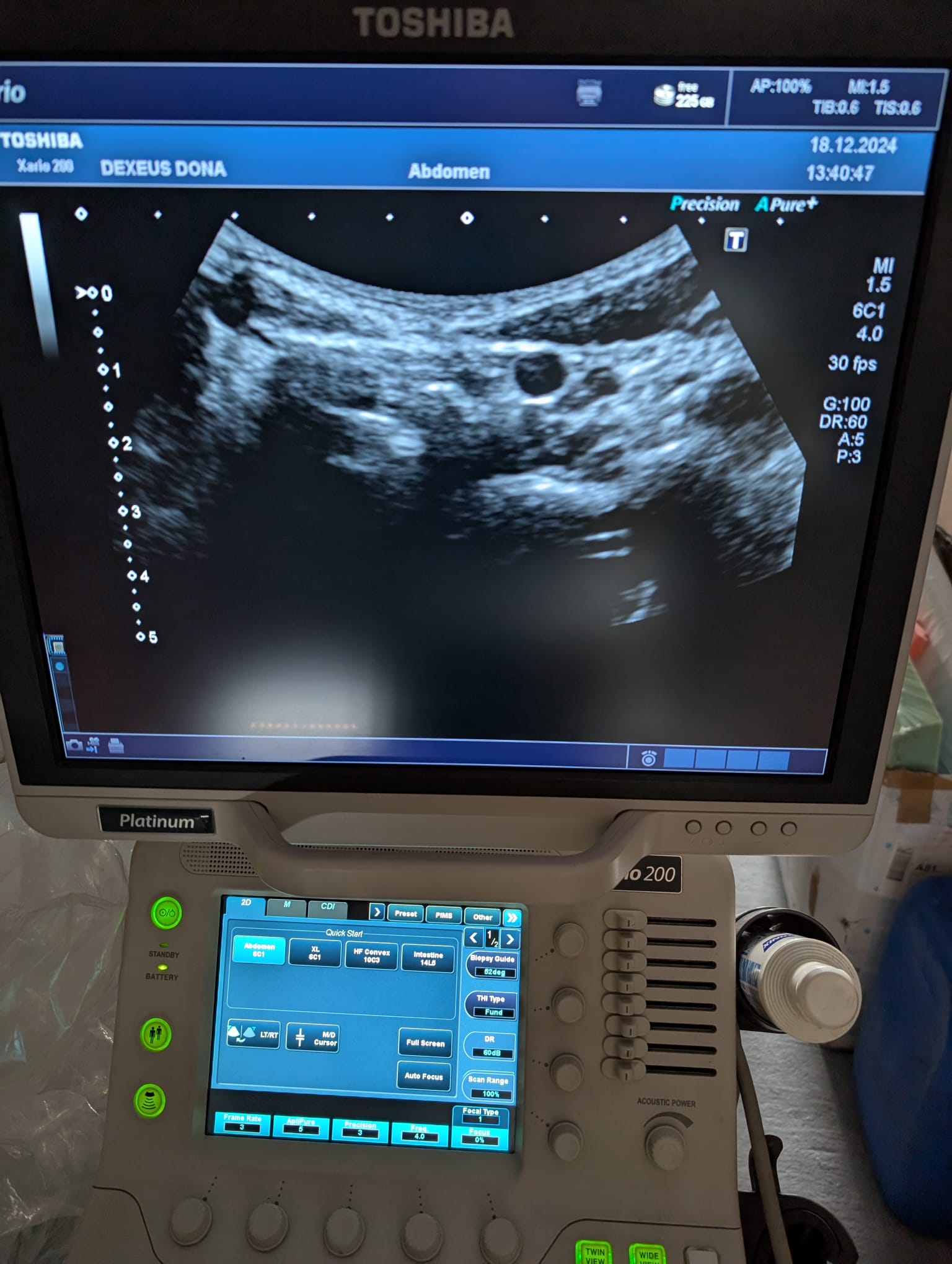 Toshiba PVU-375BT - Imagen 5