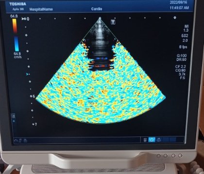 Toshiba PST-30BT - Imagen 3