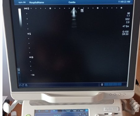 Toshiba PST-30BT - Imagen 4