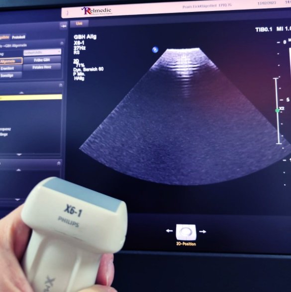 Philips X6-1 Compact - Imagen 5