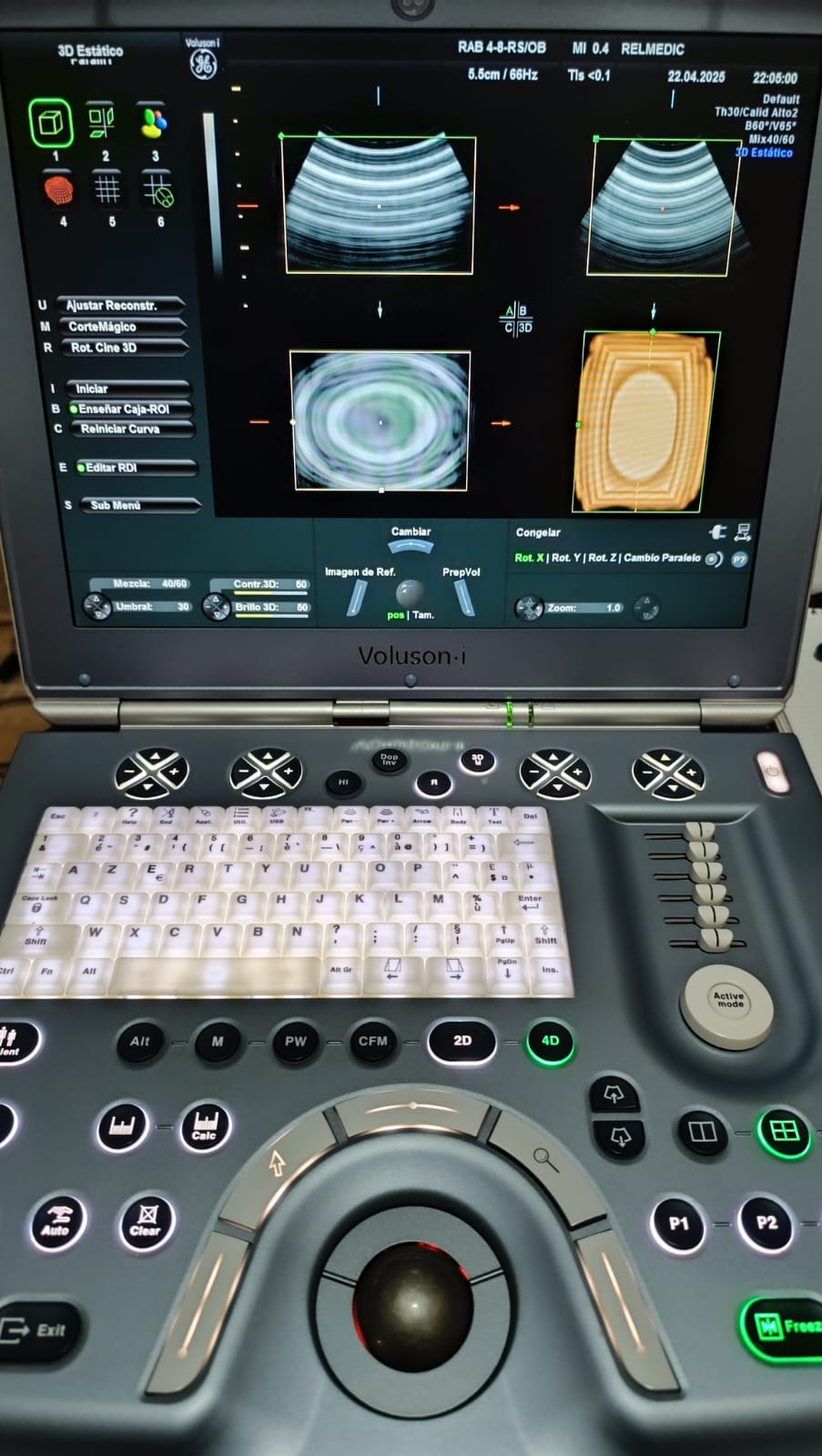 VOLUSON i - Imagen 2