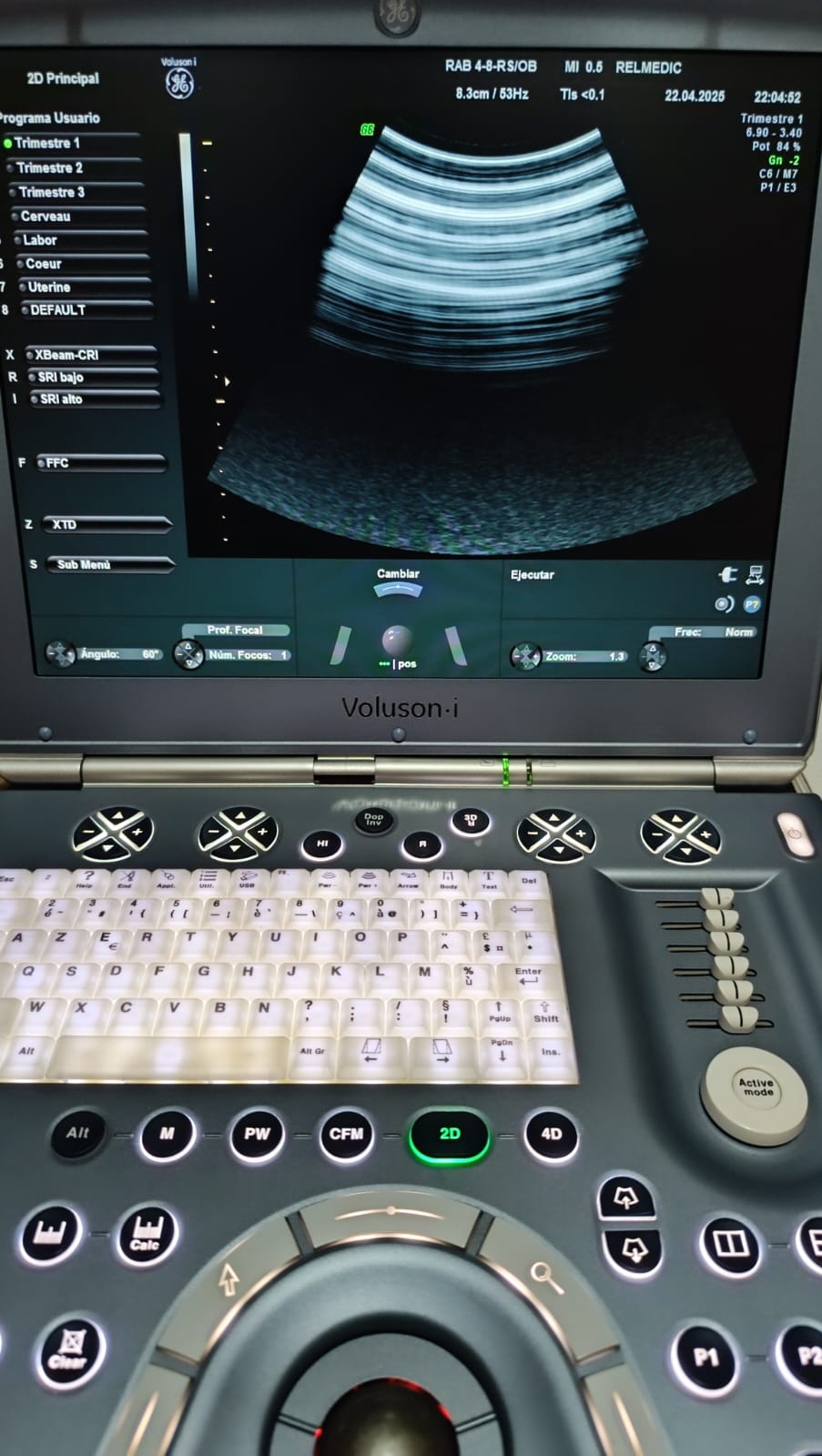 VOLUSON i - Imagen 3