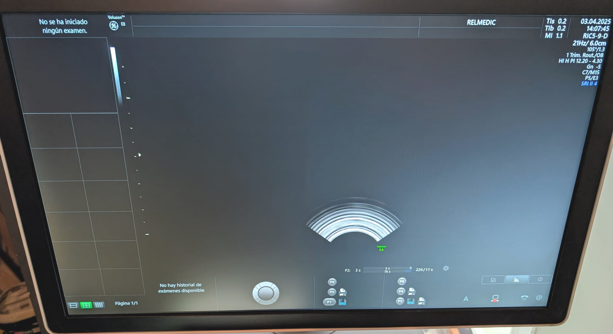 VOLUSON E8 BT20 - Imagen 11