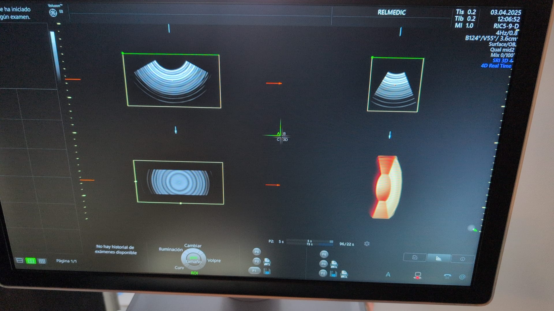 VOLUSON E8 BT20 - Imagen 12