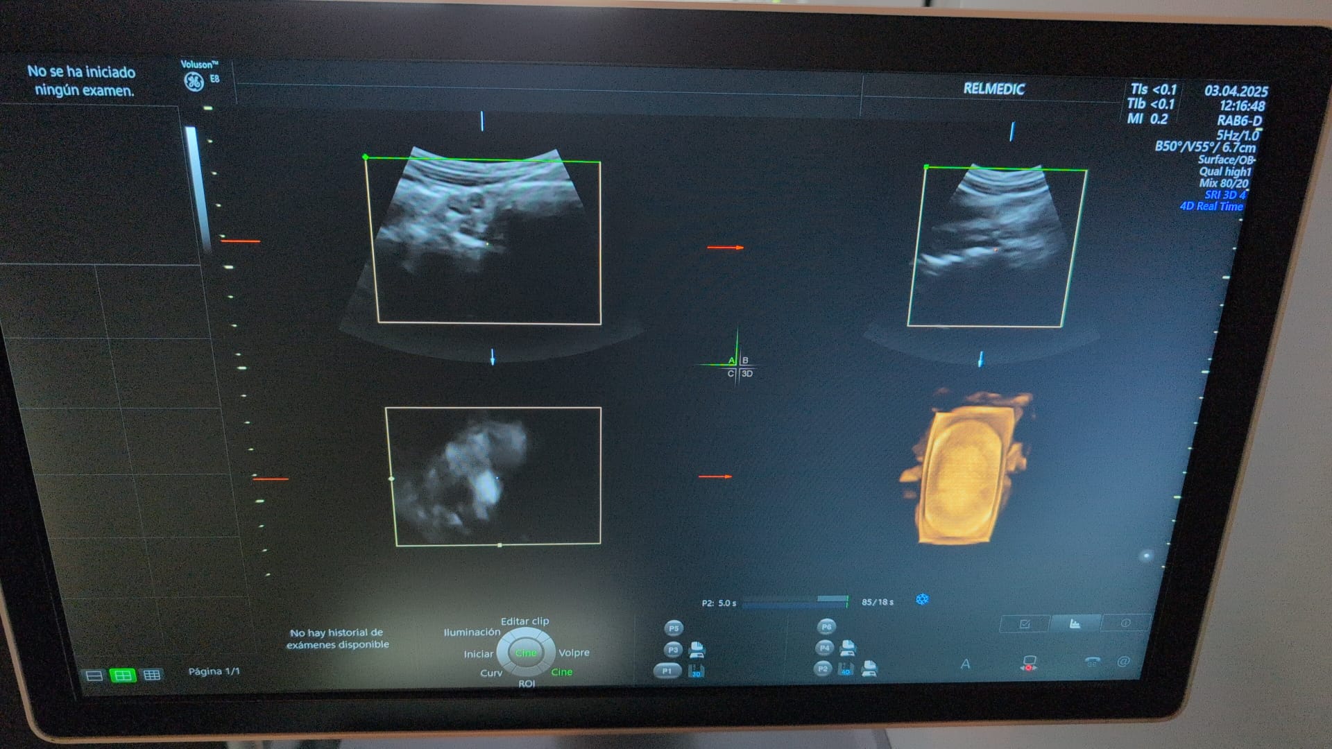 VOLUSON E8 BT20 - Imagen 13