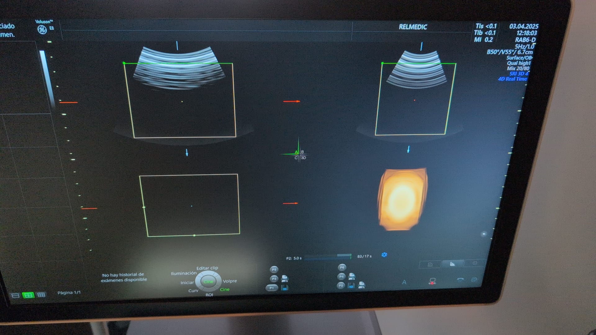 VOLUSON E8 BT20 - Imagen 14