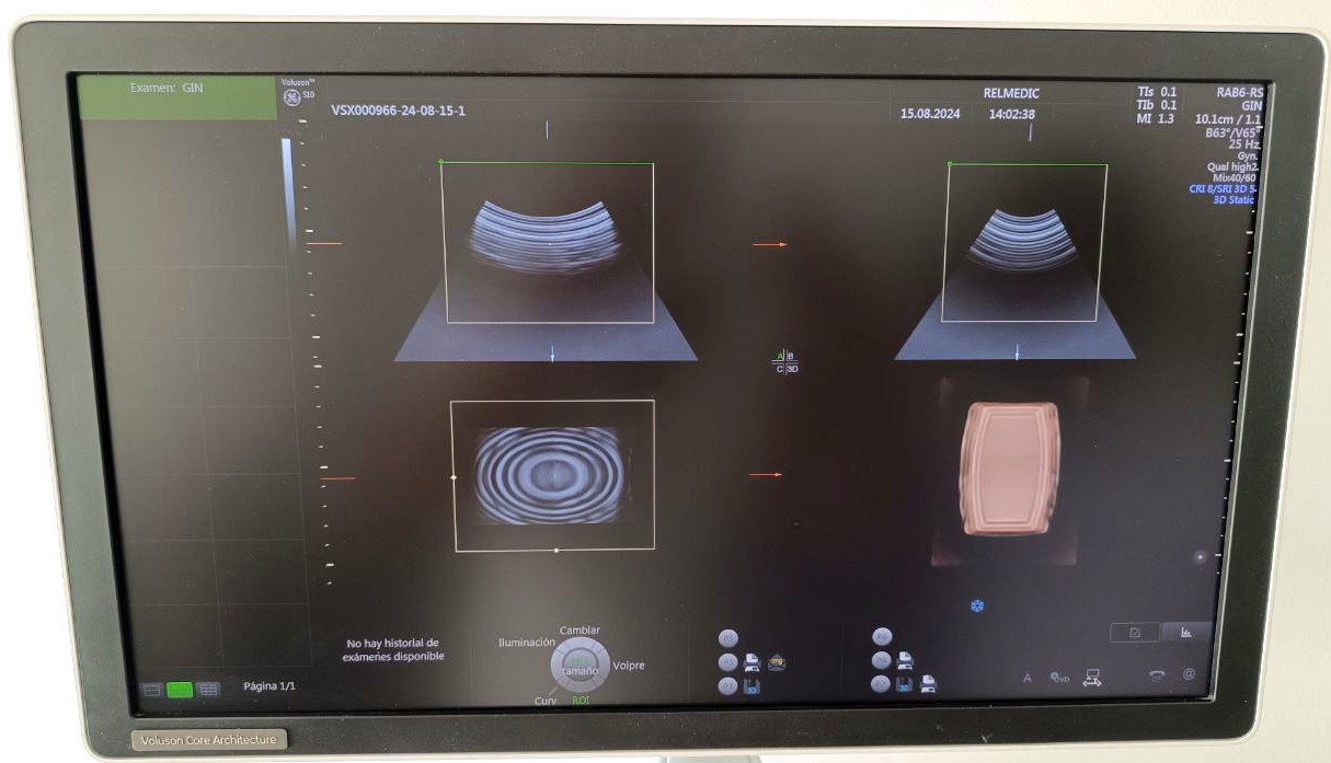 VOLUSON S10 BT16 - Imagen 6