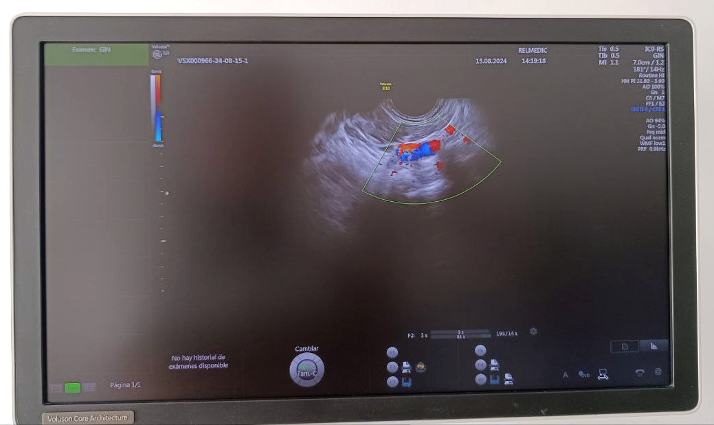 VOLUSON S10 BT16 - Imagen 2