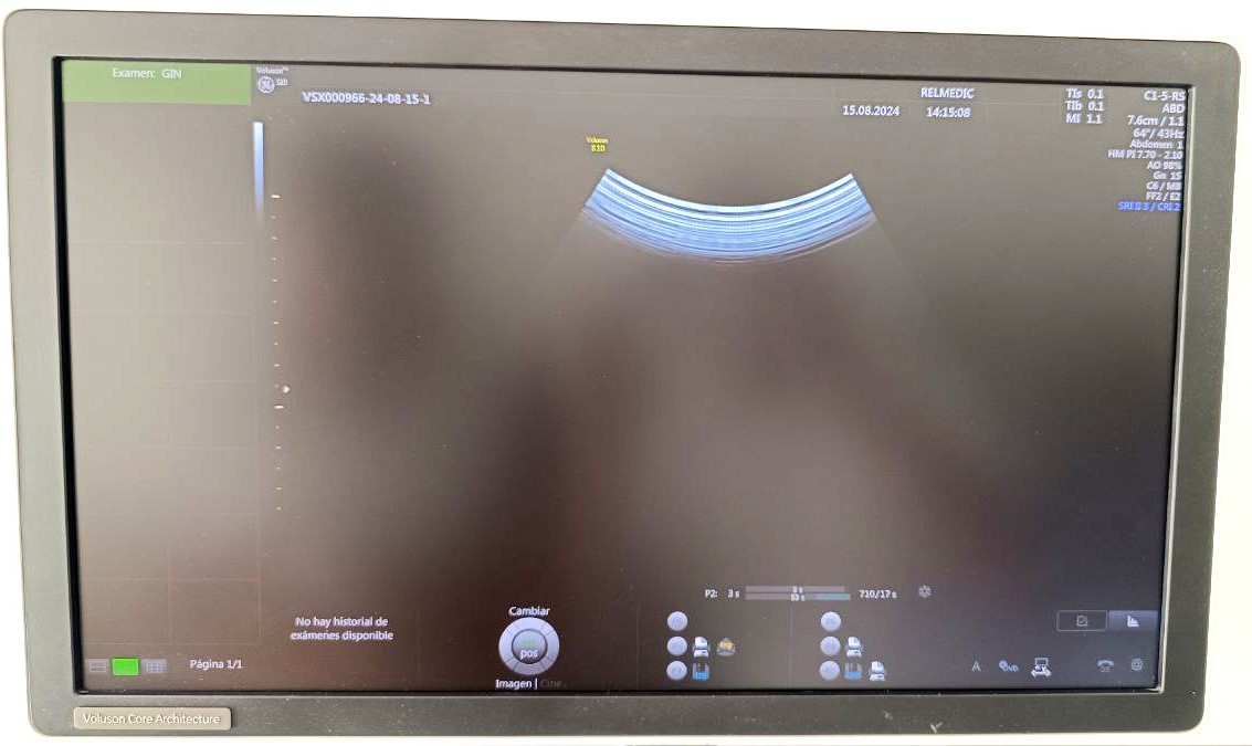 VOLUSON S10 BT16 - Imagen 5