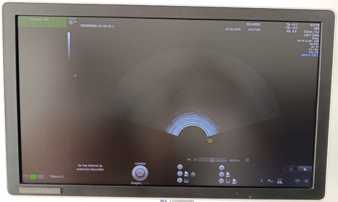 VOLUSON S10 BT16 - Imagen 4