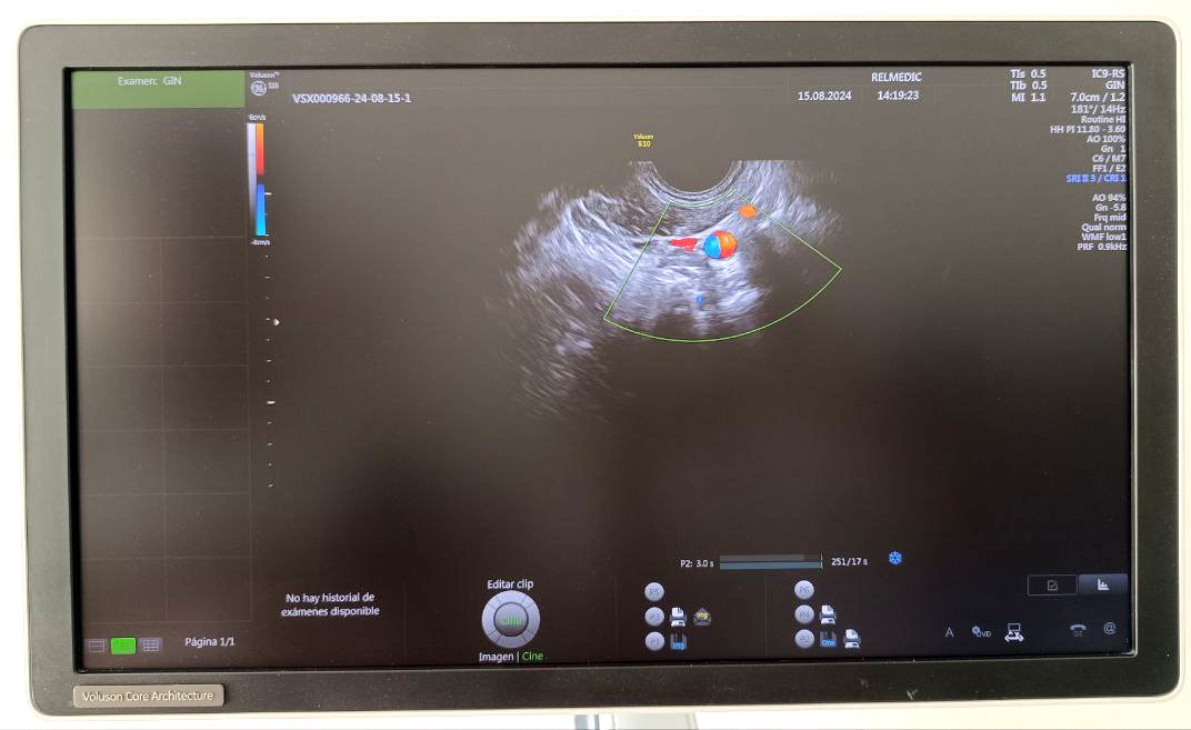 VOLUSON S10 BT16 - Imagen 3