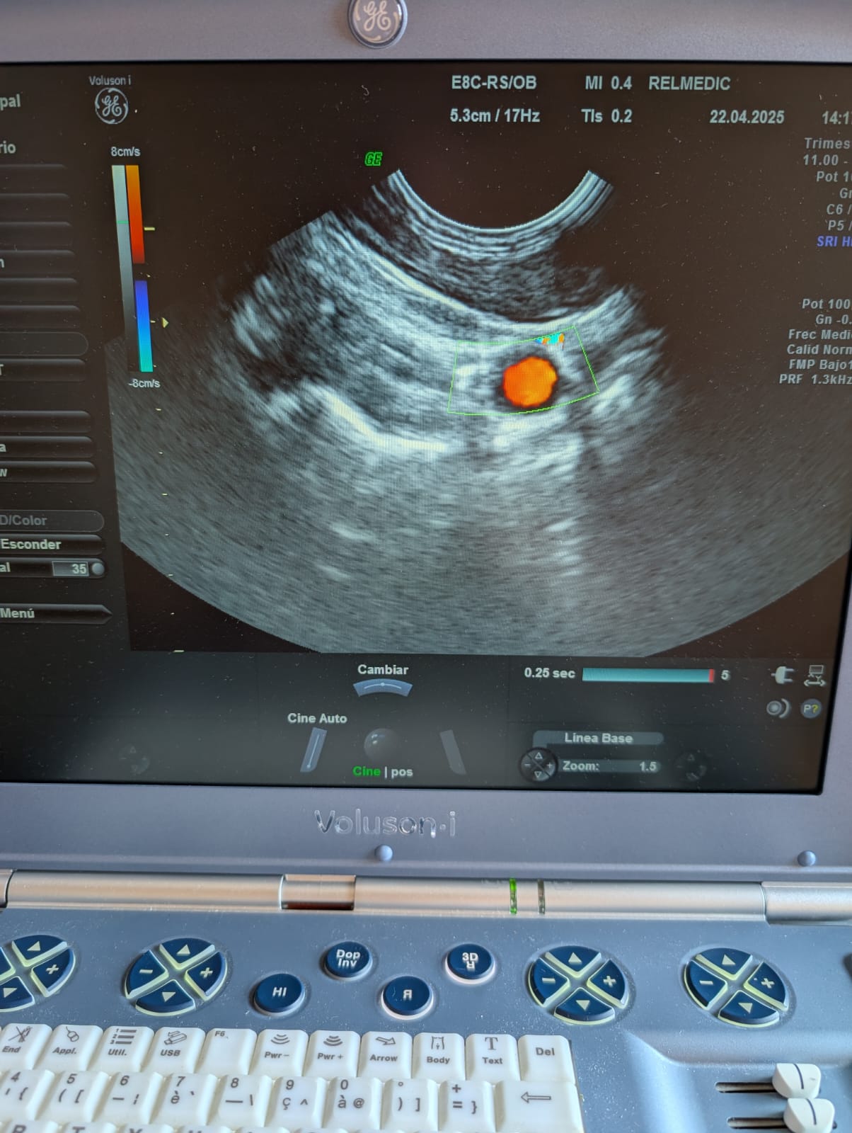 VOLUSON i - Imagen 5