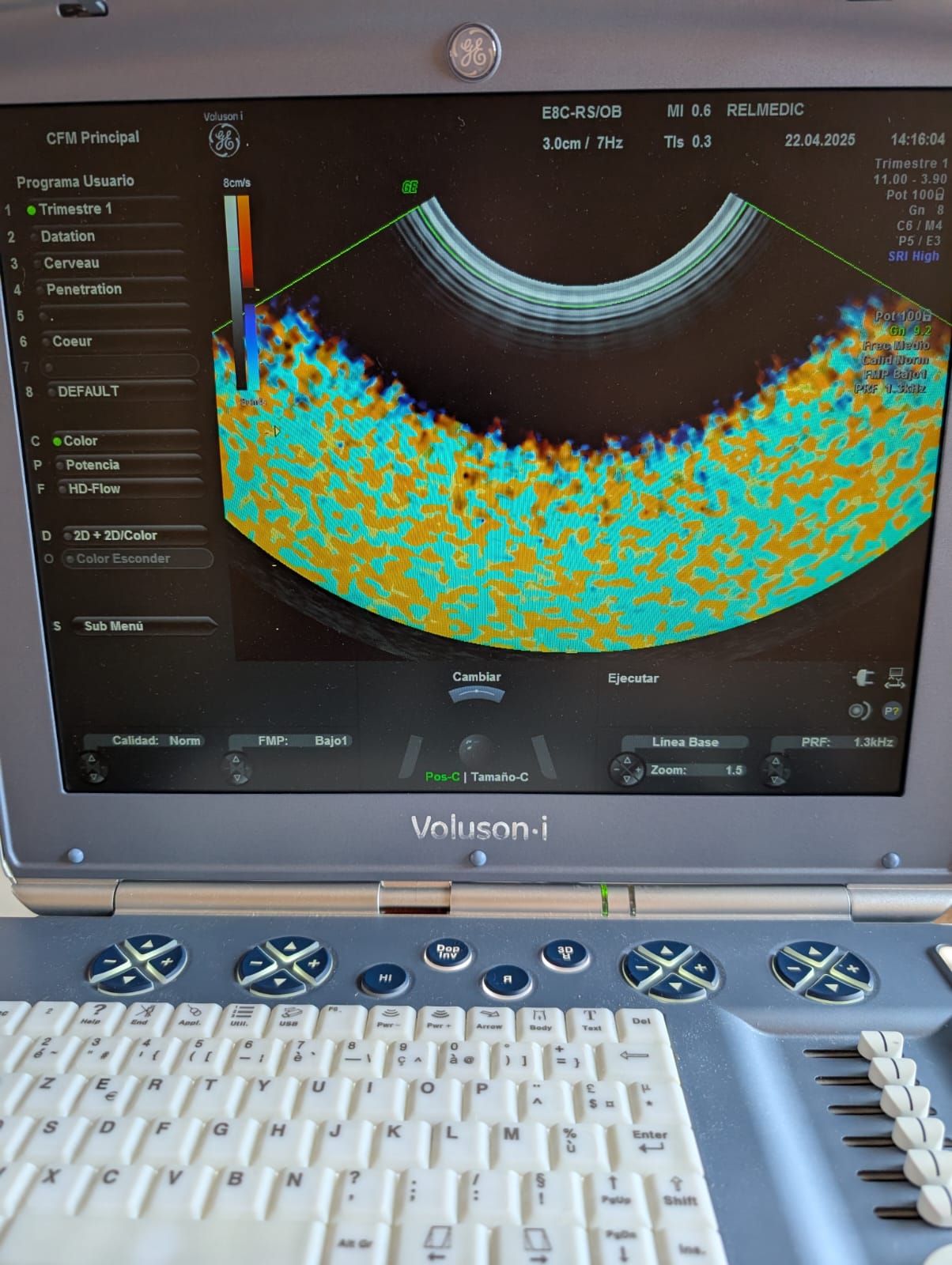 VOLUSON i - Imagen 6