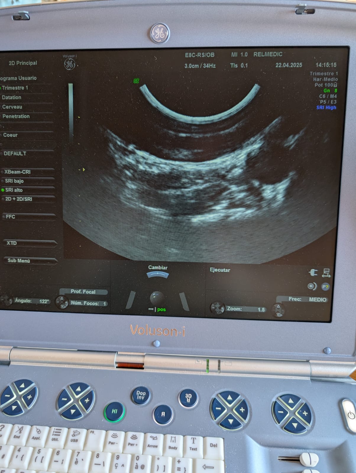 VOLUSON i - Imagen 7