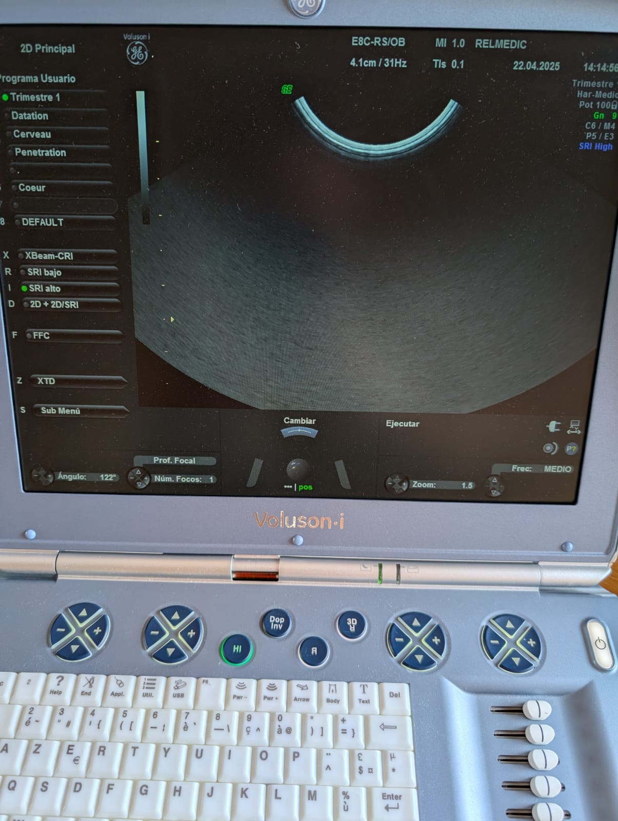 VOLUSON i - Imagen 8