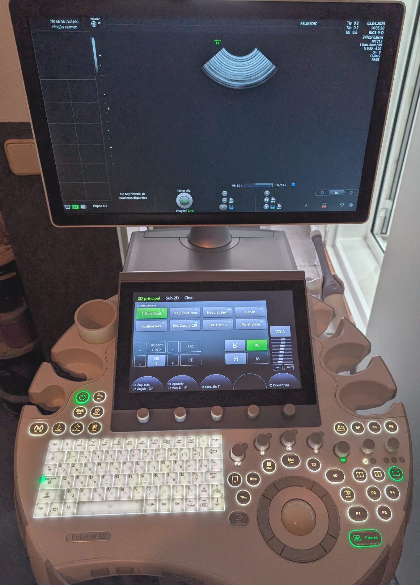 VOLUSON E8 BT20 - Imagen 10