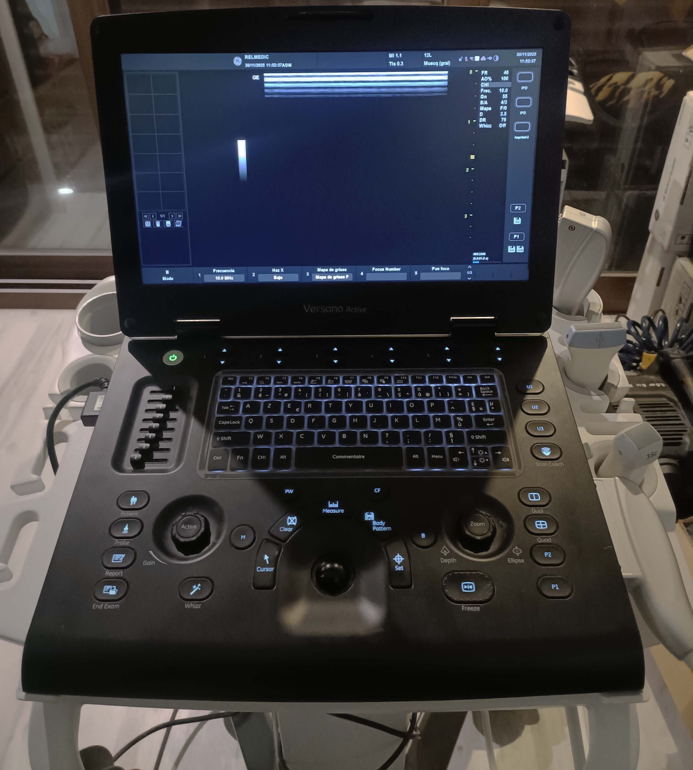 GE VERSANA ACTIVE - Imagen 5