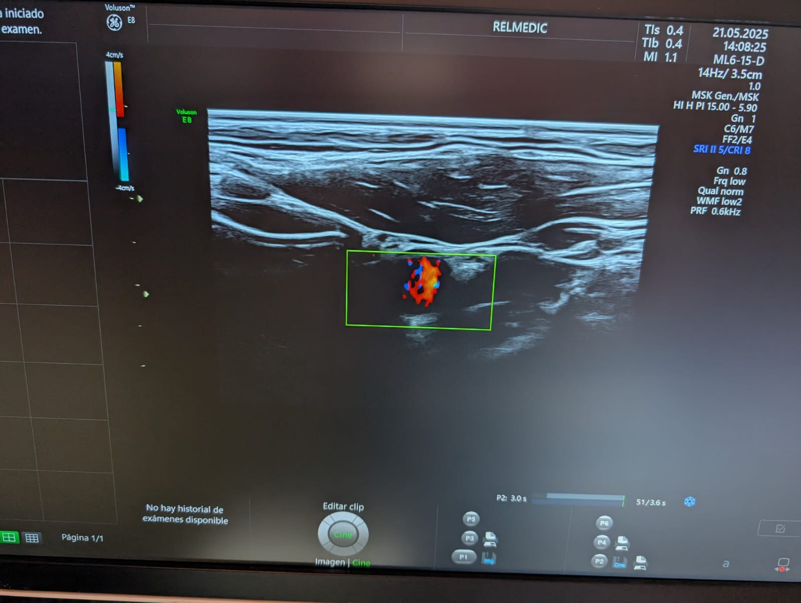 GE ML6-15-D - Imagen 7