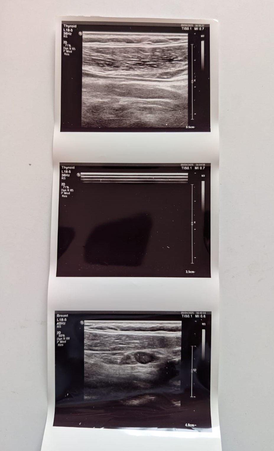 PHILIPS L18-5 - Image 7