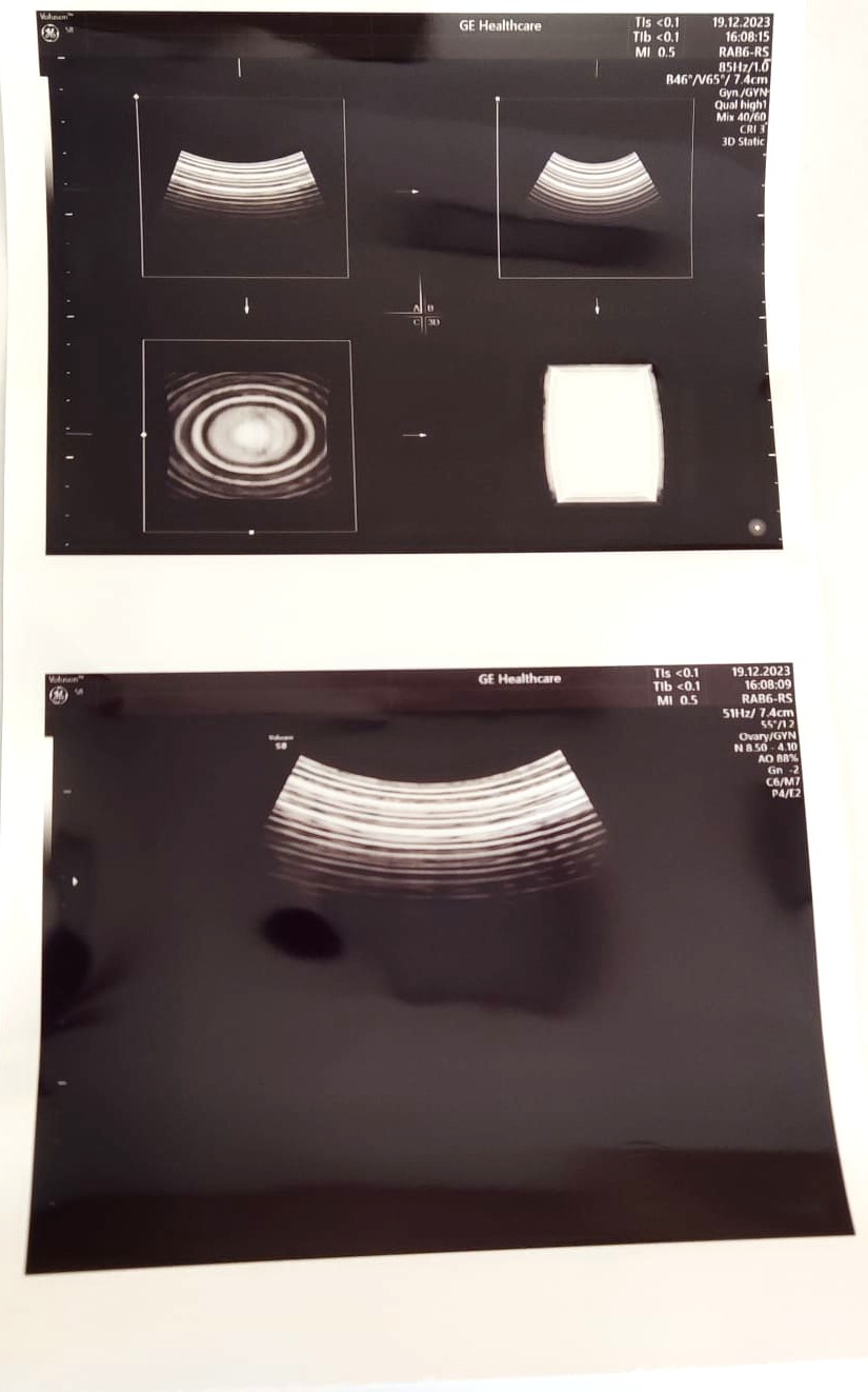 GE RAB6-RS - Imagen 6