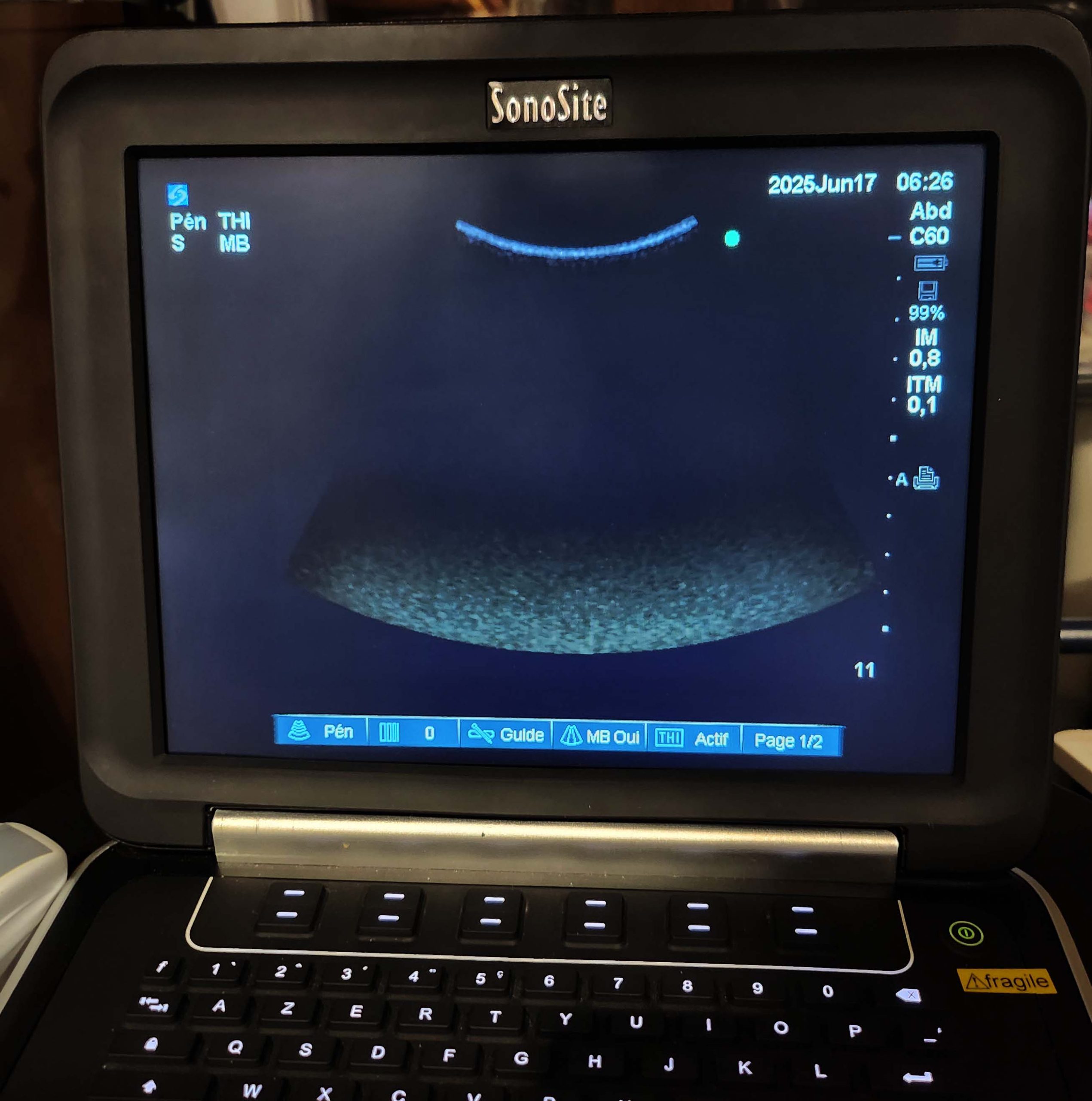 Ecógrafo Sonosite Edge - Imagen 8