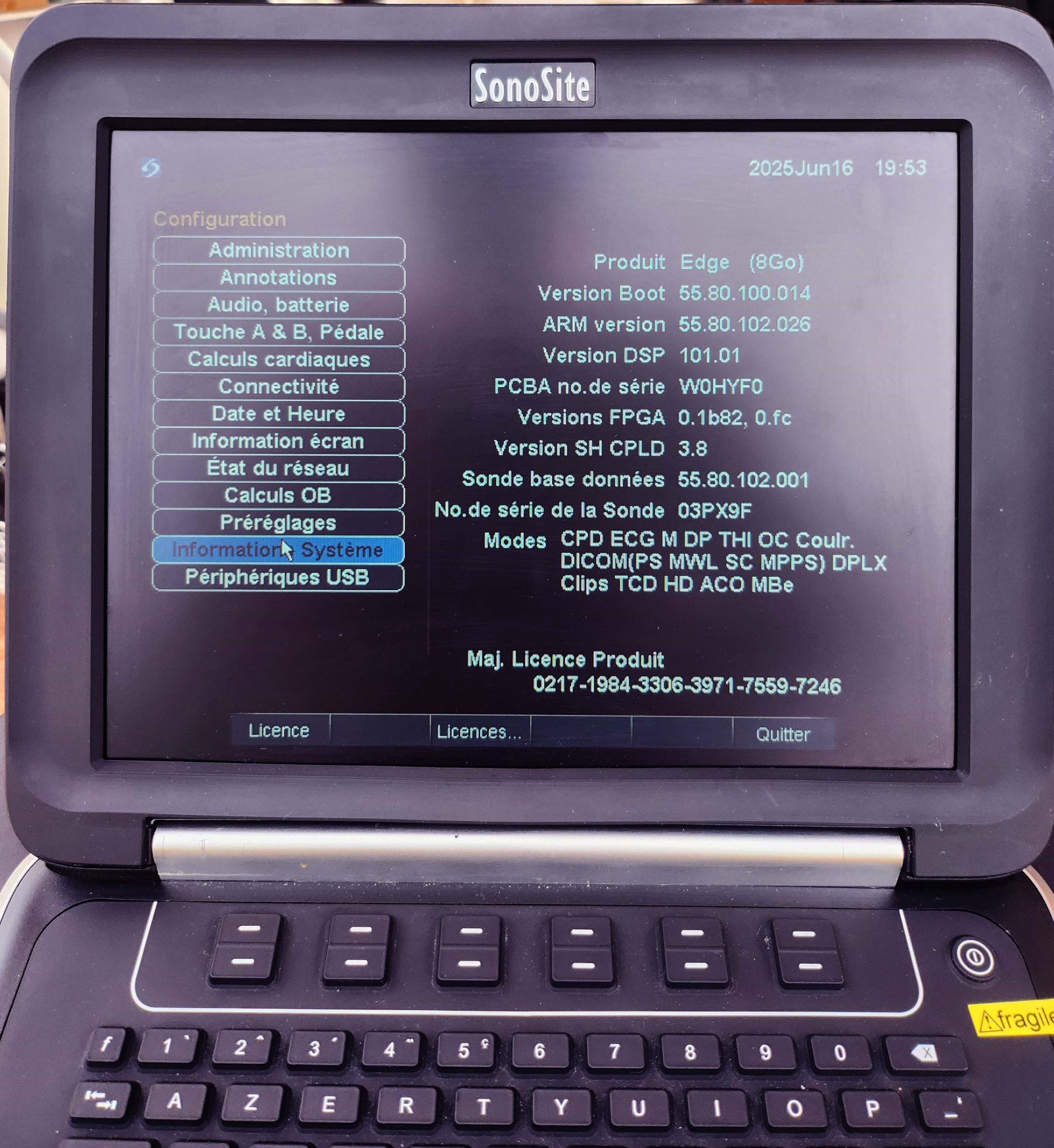 Ecógrafo Sonosite Edge - Imagen 5