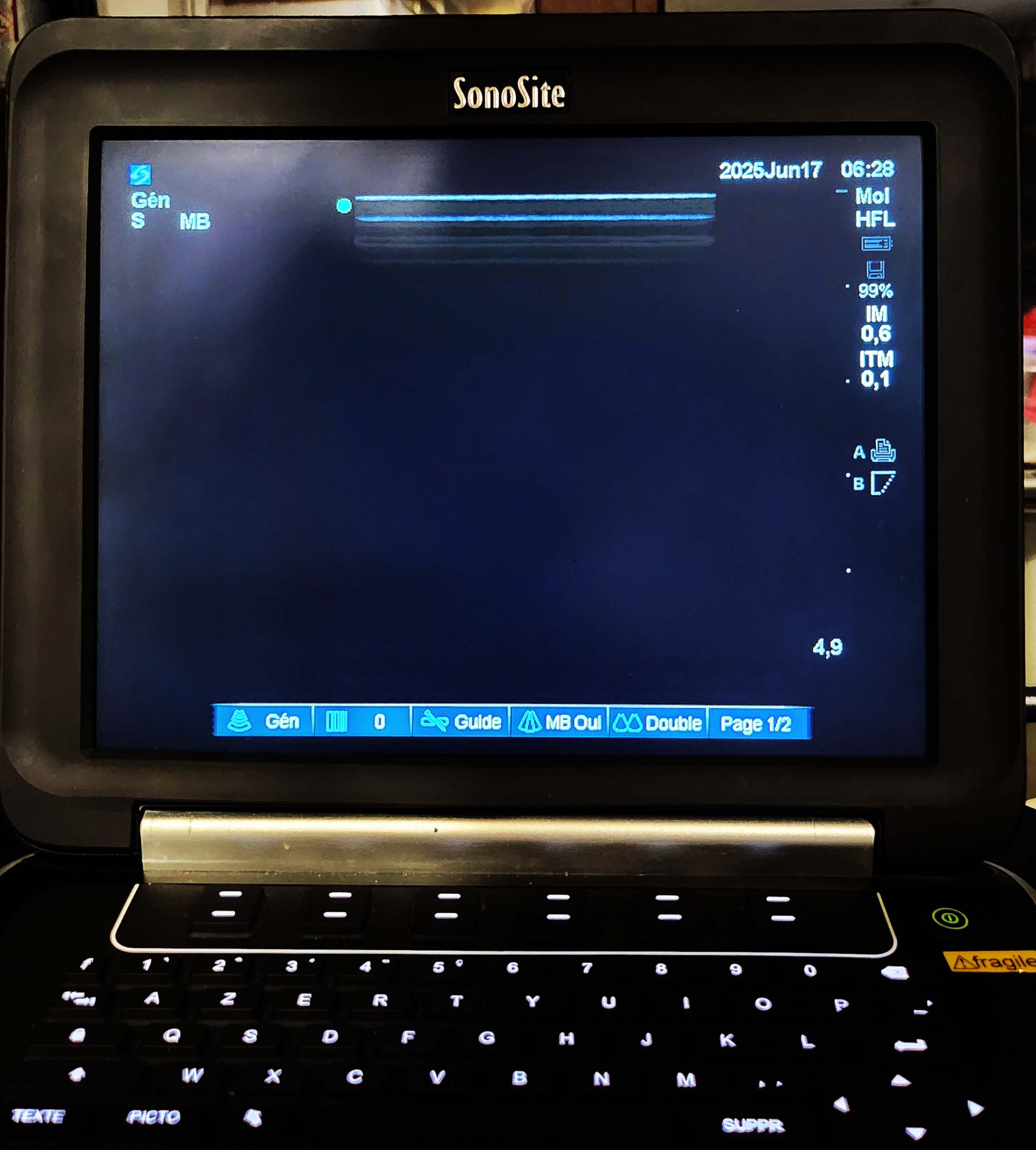 Ecógrafo Sonosite Edge - Imagen 7